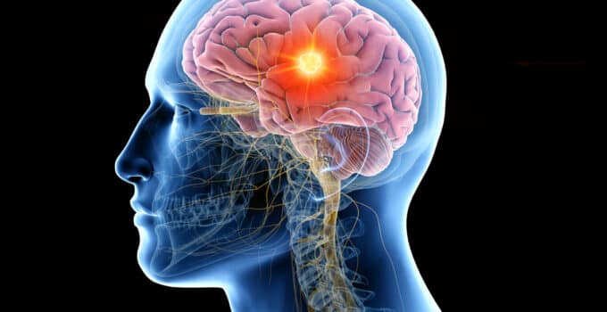 Breakthrough tech can detect Alzheimer’s in a single brain scan