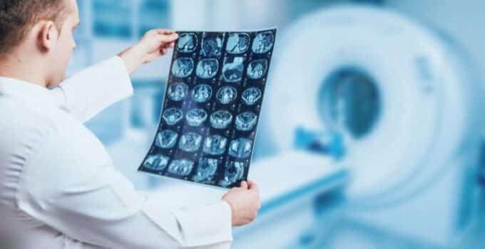 Steps to Become a Radiology Technician  