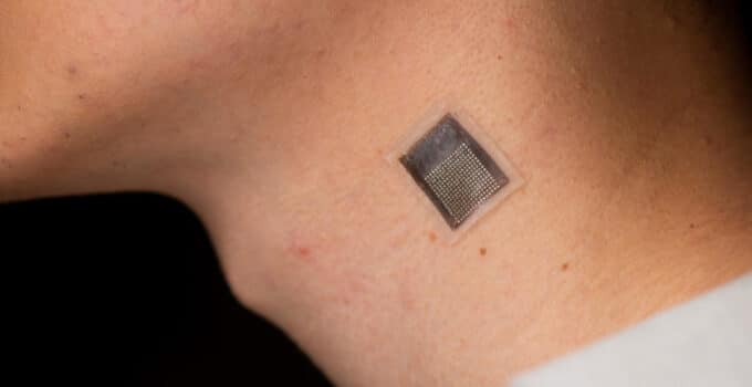 Transformative Technology for Deep Tissue Monitoring: Wearable Ultrasound Patches